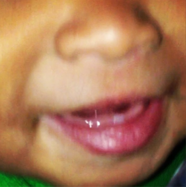 He’s showing off his grill! His first baby tooth at eight months old.