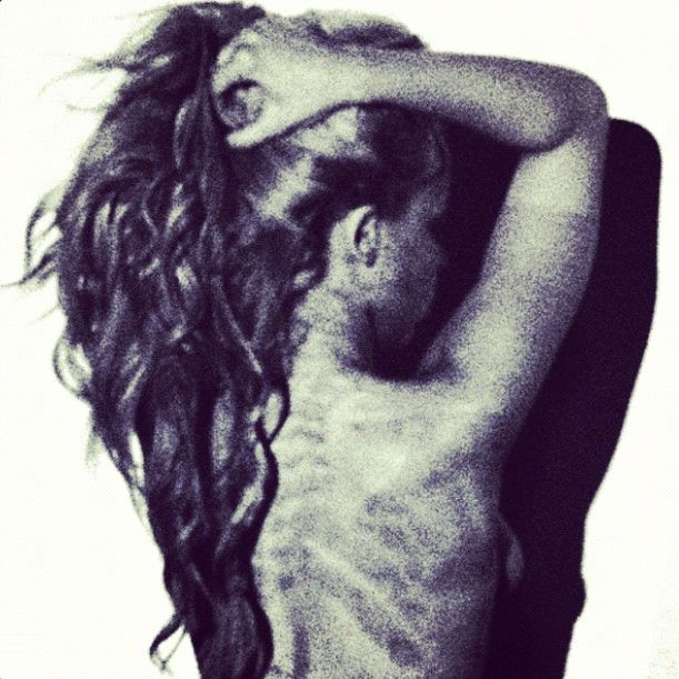 In Case We Die Artwork