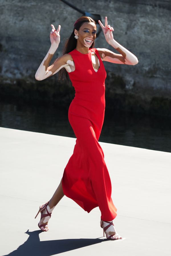 Winnie Harlow