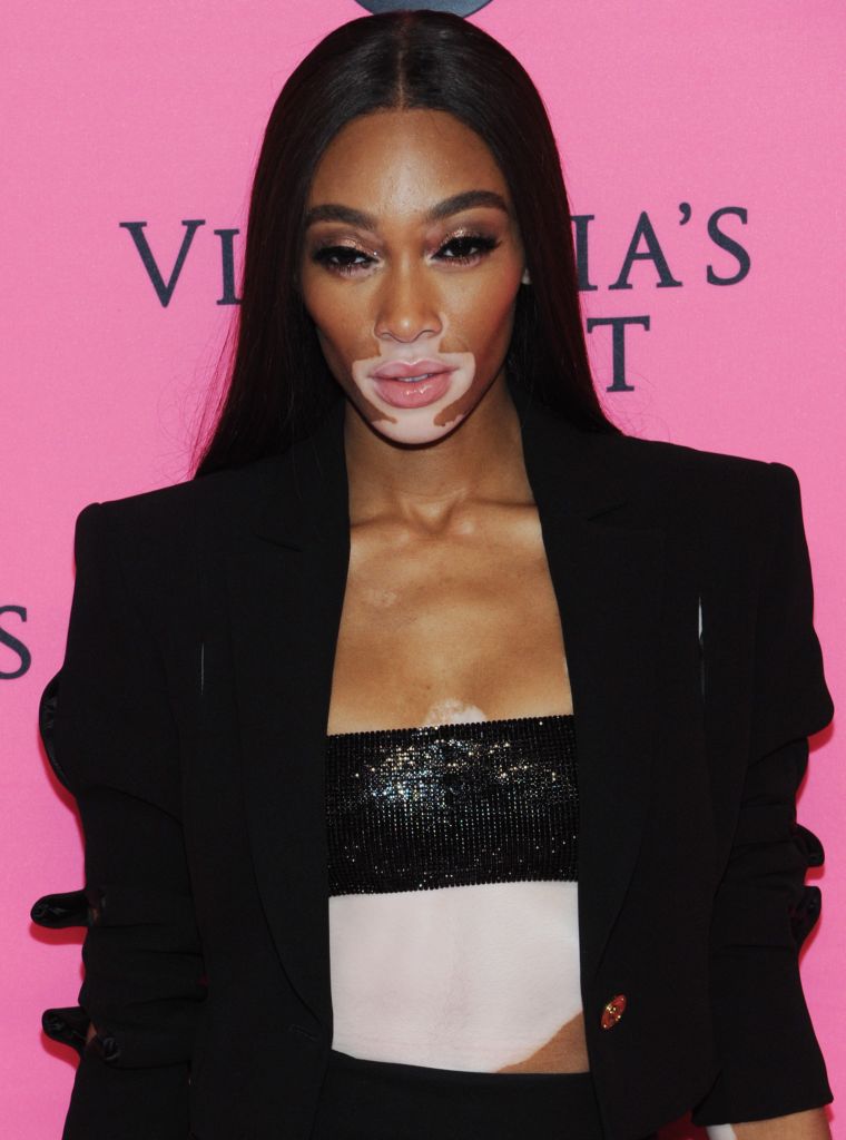 Winnie Harlow