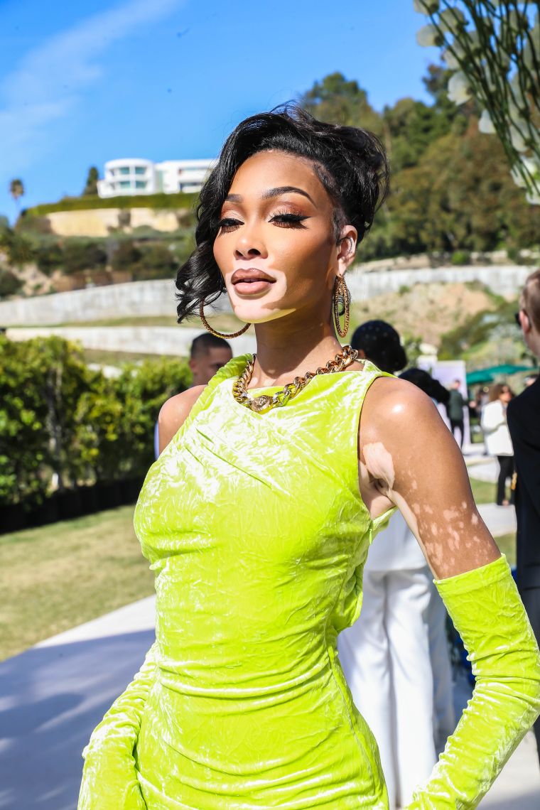 Winnie Harlow Glowing In Green